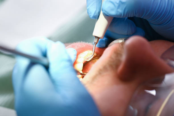 Best Emergency Wisdom Teeth Removal in Moonachie, NJ