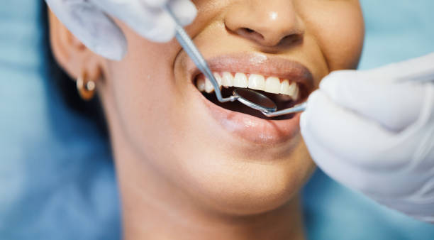 Best Emergency Treatment for Dental Infections or Abscesses in Moonachie, NJ